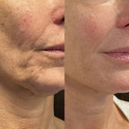 Freya Anti-Aging Serum Stick | Bee Venom, Triple Peptide | 30ml