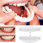 Delphine | Clip-On Veneers | Upper & Lower Set | Snap-On Smile Cover