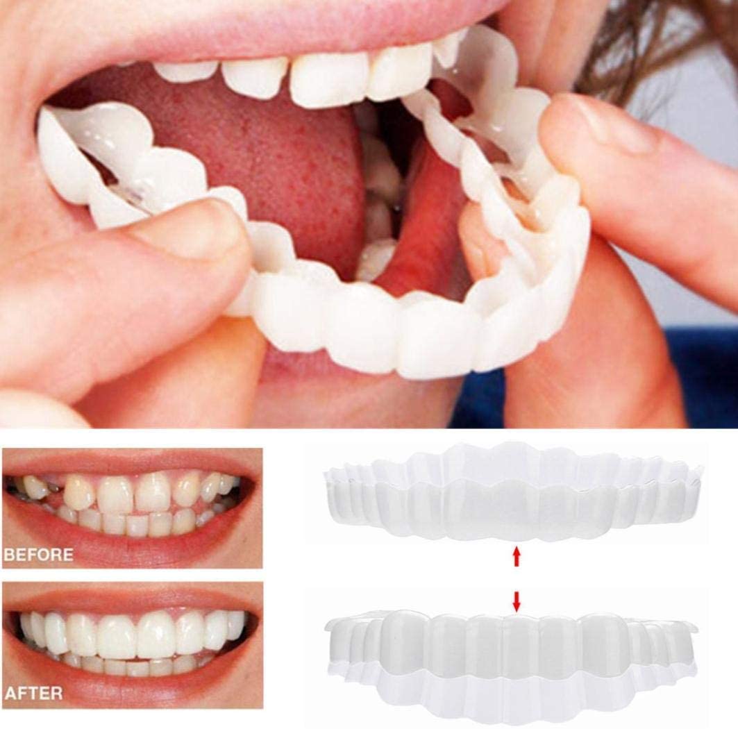 Delphine | Clip-On Veneers | Upper & Lower Set | Snap-On Smile Cover