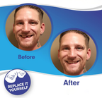 Delphine | Clip-On Veneers | Upper & Lower Set | Snap-On Smile Cover
