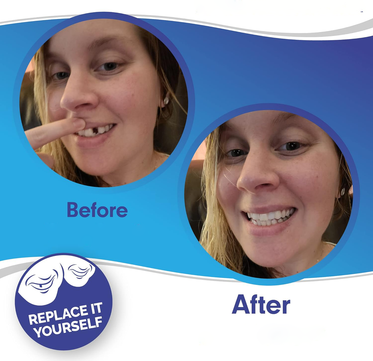 Delphine | Clip-On Veneers | Upper & Lower Set | Snap-On Smile Cover