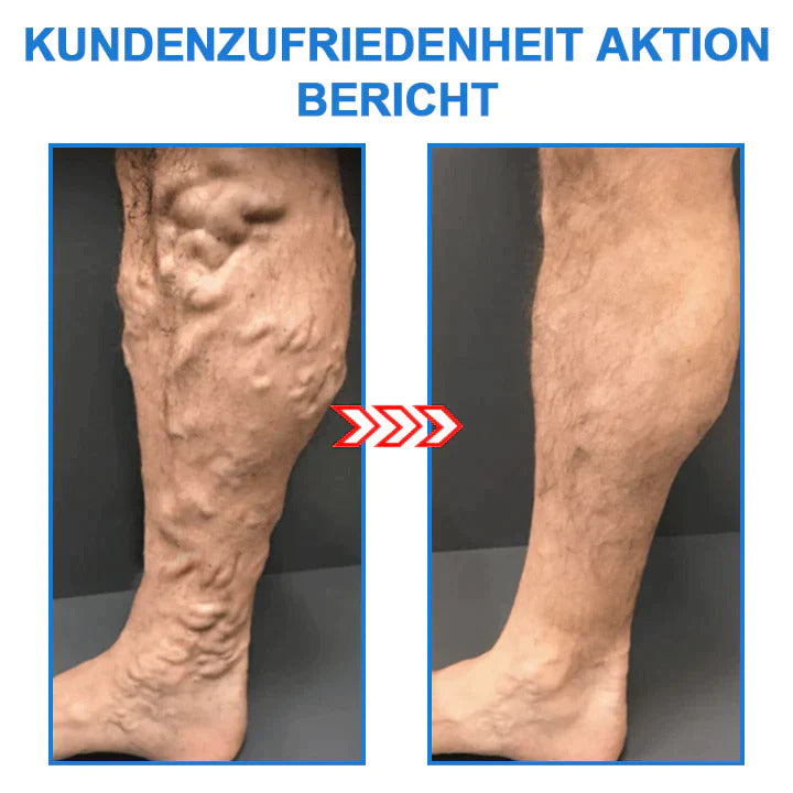 Compression Socks | Slimmer Legs, Firmer Skin | Tourmaline Ion Technology