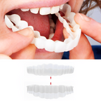 Delphine | Clip-On Veneers | Upper & Lower Set | Snap-On Smile Cover